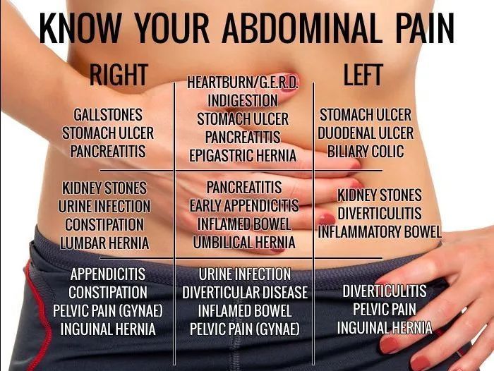 Know Your Abdominal Pain
